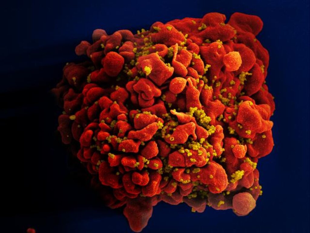 HIV-infekterad H9 T cell