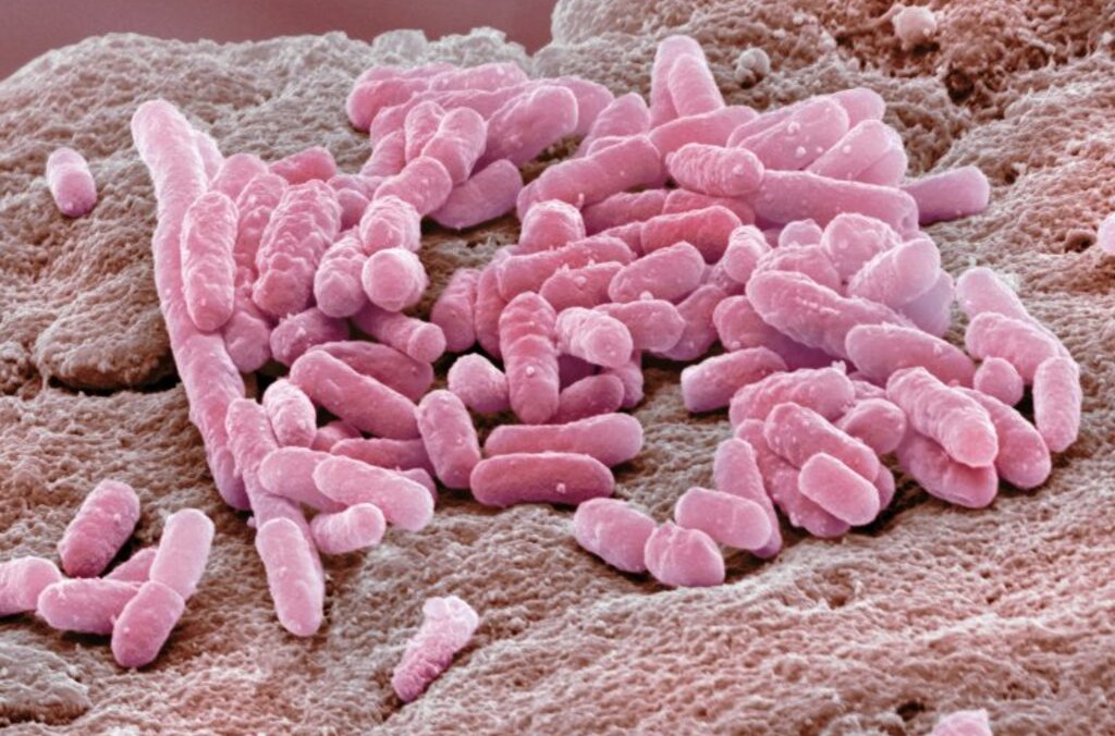 E Coli