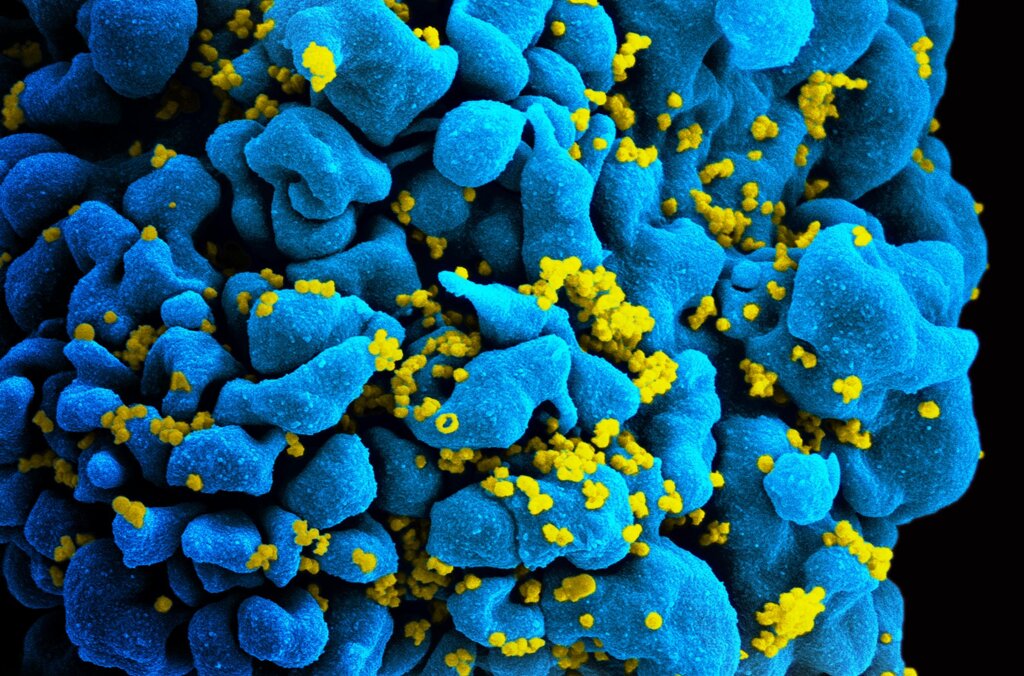 Virus